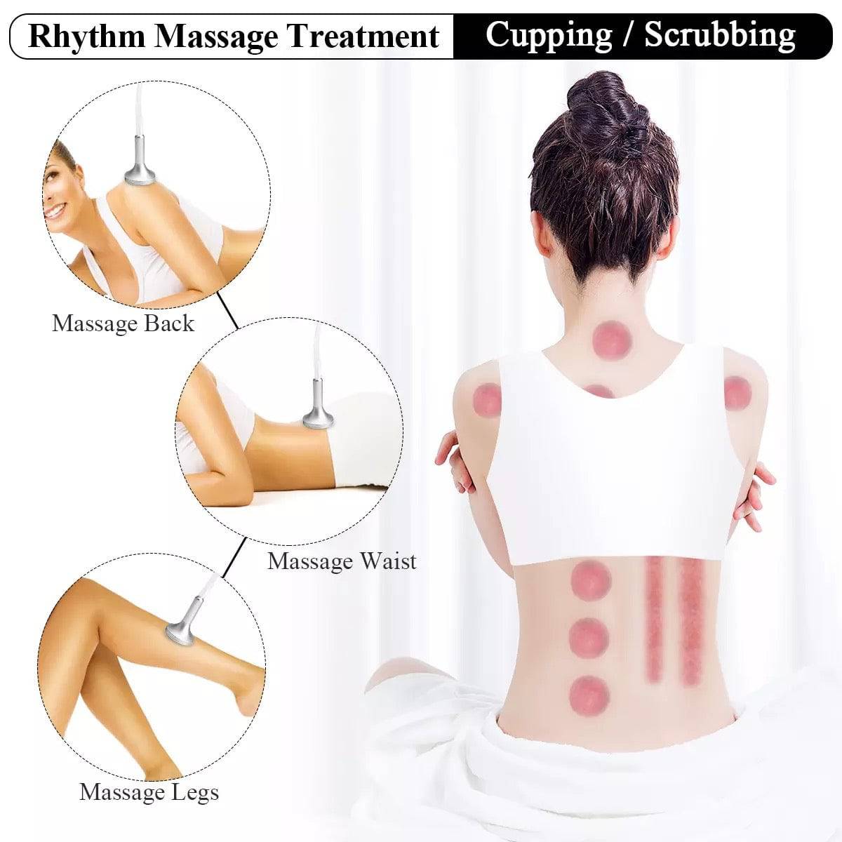 Body Shaping Vacuum Therapy Machine with XXL Cups - Foreverfly