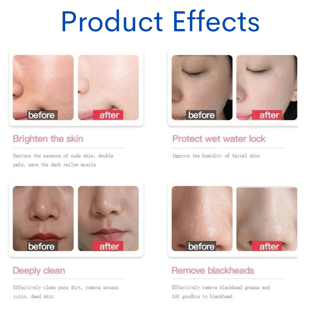 Aqua Clean Concentrated Hydrafacial Solution 3pcs Set - Foreverfly