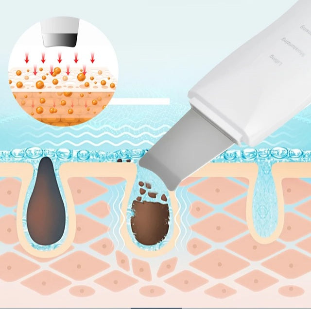 Ultrasonic Exfoliating Wand - Foreverfly