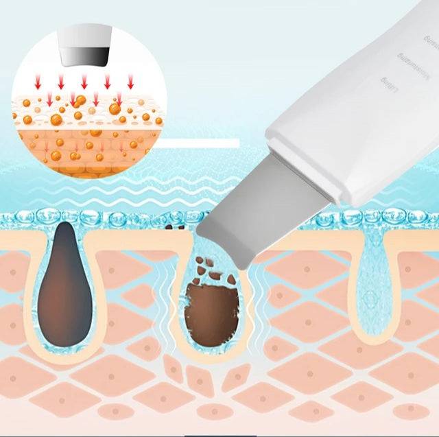 Ultrasonic Exfoliating Wand - Foreverfly