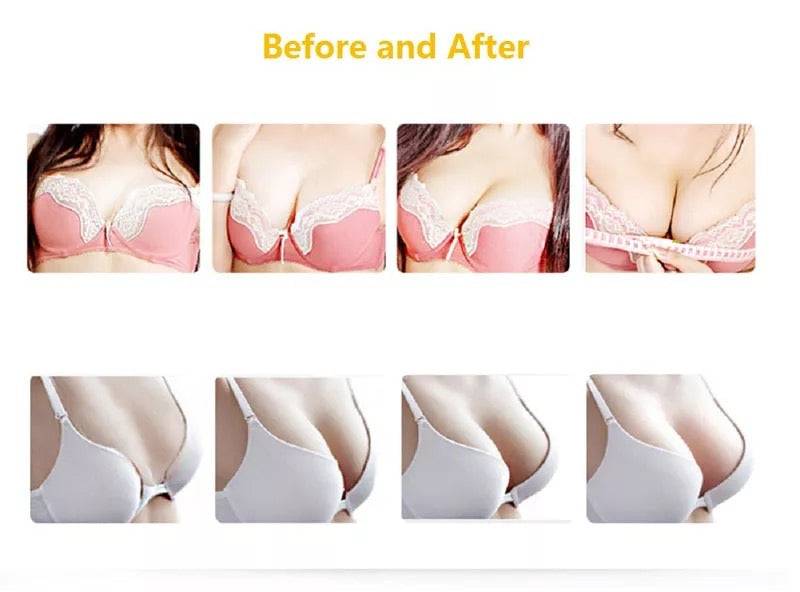 Body Shaping Vacuum Therapy Machine with XXL Cups - Foreverfly