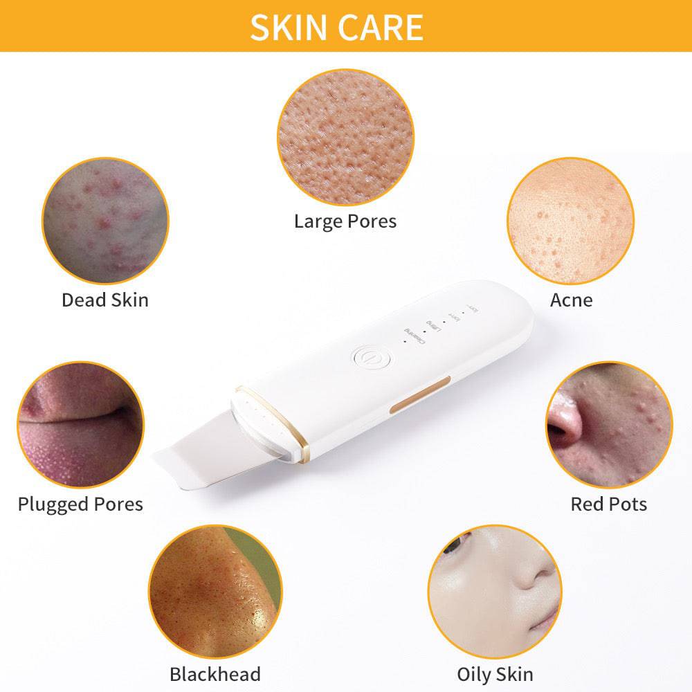 Ultrasonic Ion Skin Scrubber - Foreverfly