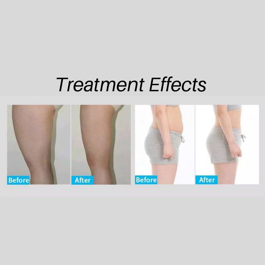 Beauty Boost Cavitation Machine + Cellulite Massage Cream - Foreverfly