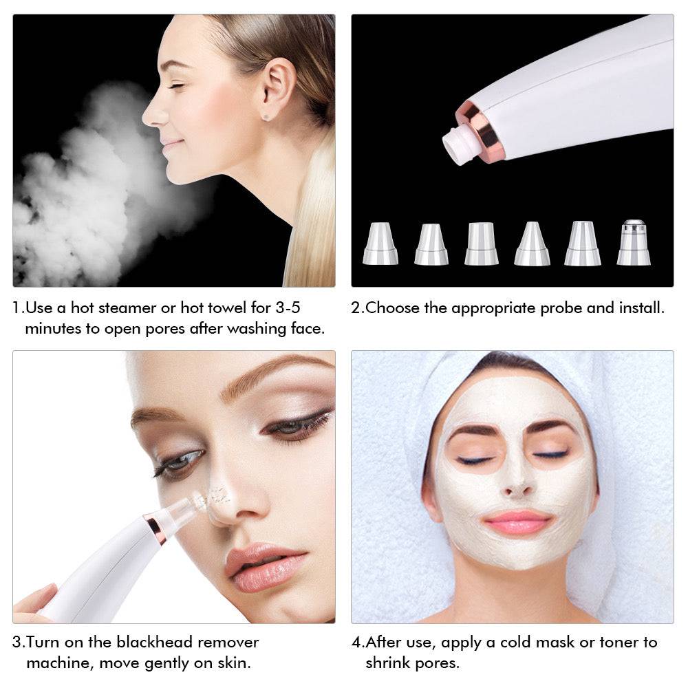 Electric Blackhead Remover Pore Cleaner - Foreverfly