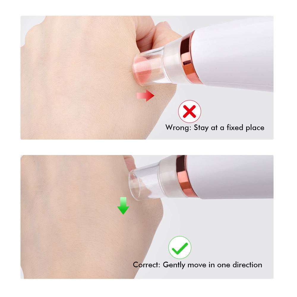 Electric Blackhead Remover Pore Cleaner - Foreverfly