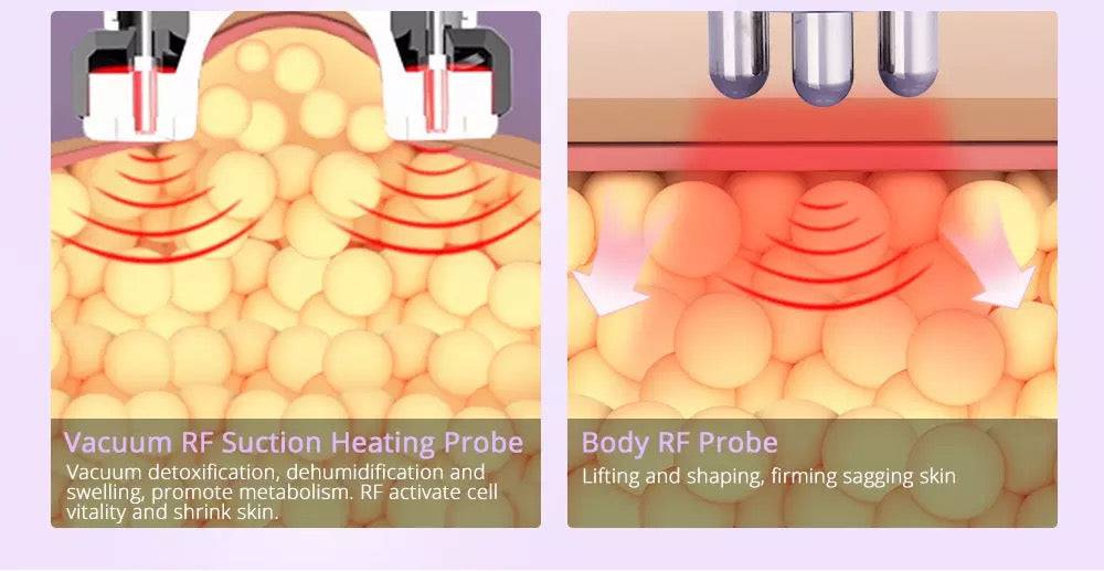 40K Cavitation Skin & Body Care 9 in 1 Machine - Foreverfly