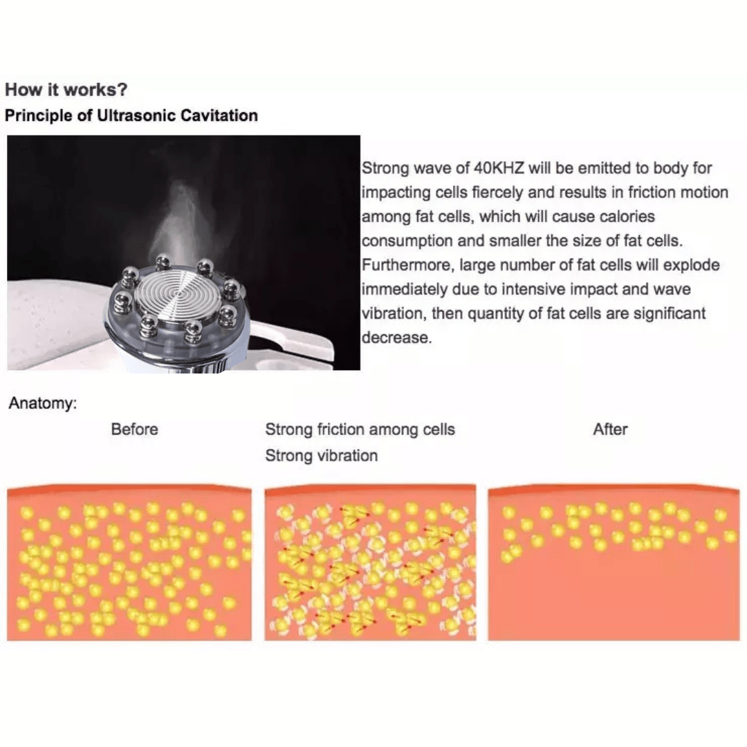 6 in 1 Cavitation Machine with 100mw Lipo Laser - Foreverfly