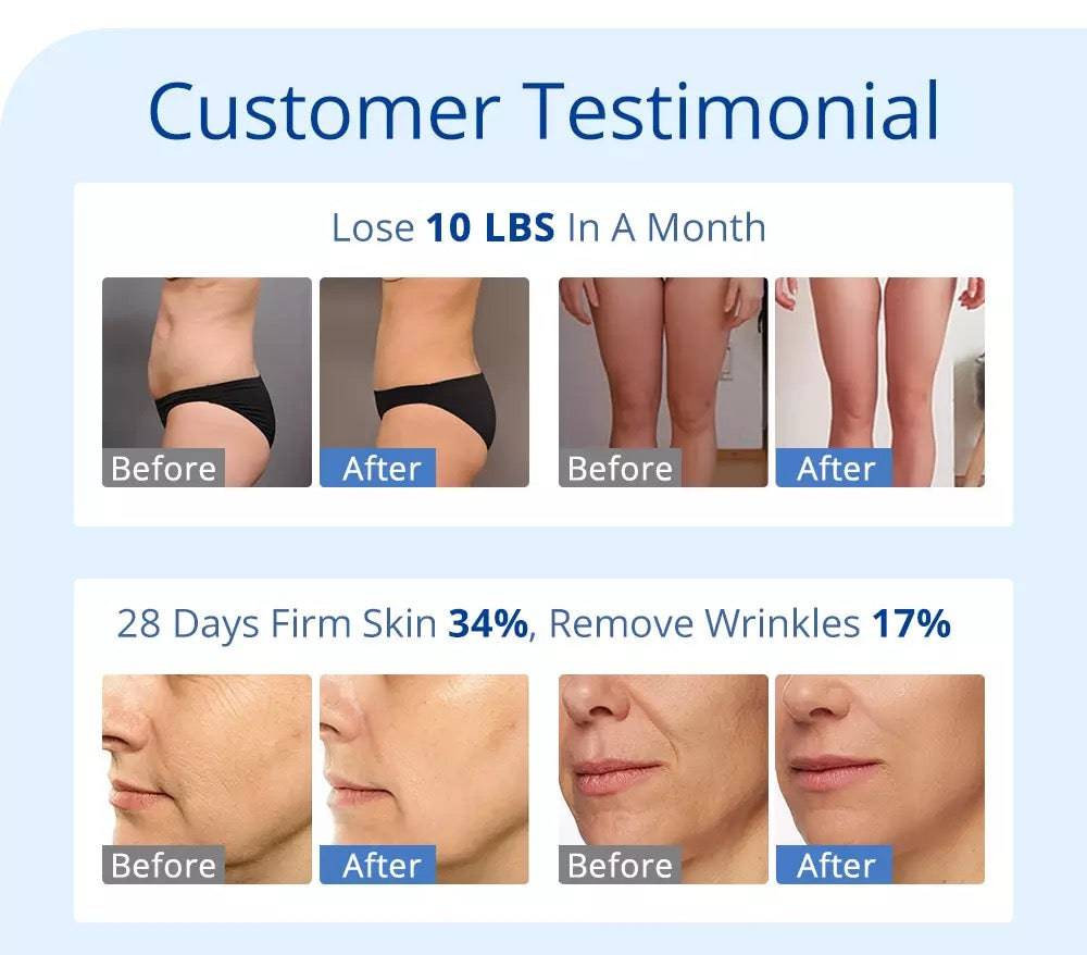 30k Cavitation Fat Removal Machine with 160mw Lipo Laser - Foreverfly