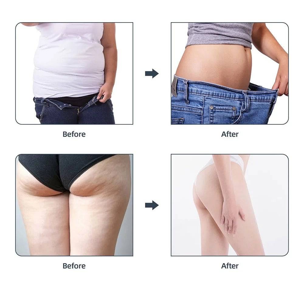 4 in 1 40k Cavitation RF Body Slimming Machine - Foreverfly