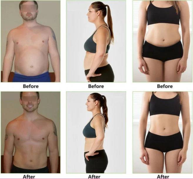9 in 1 Cavitation Lipo Laser Body Sculpting Machine - Foreverfly