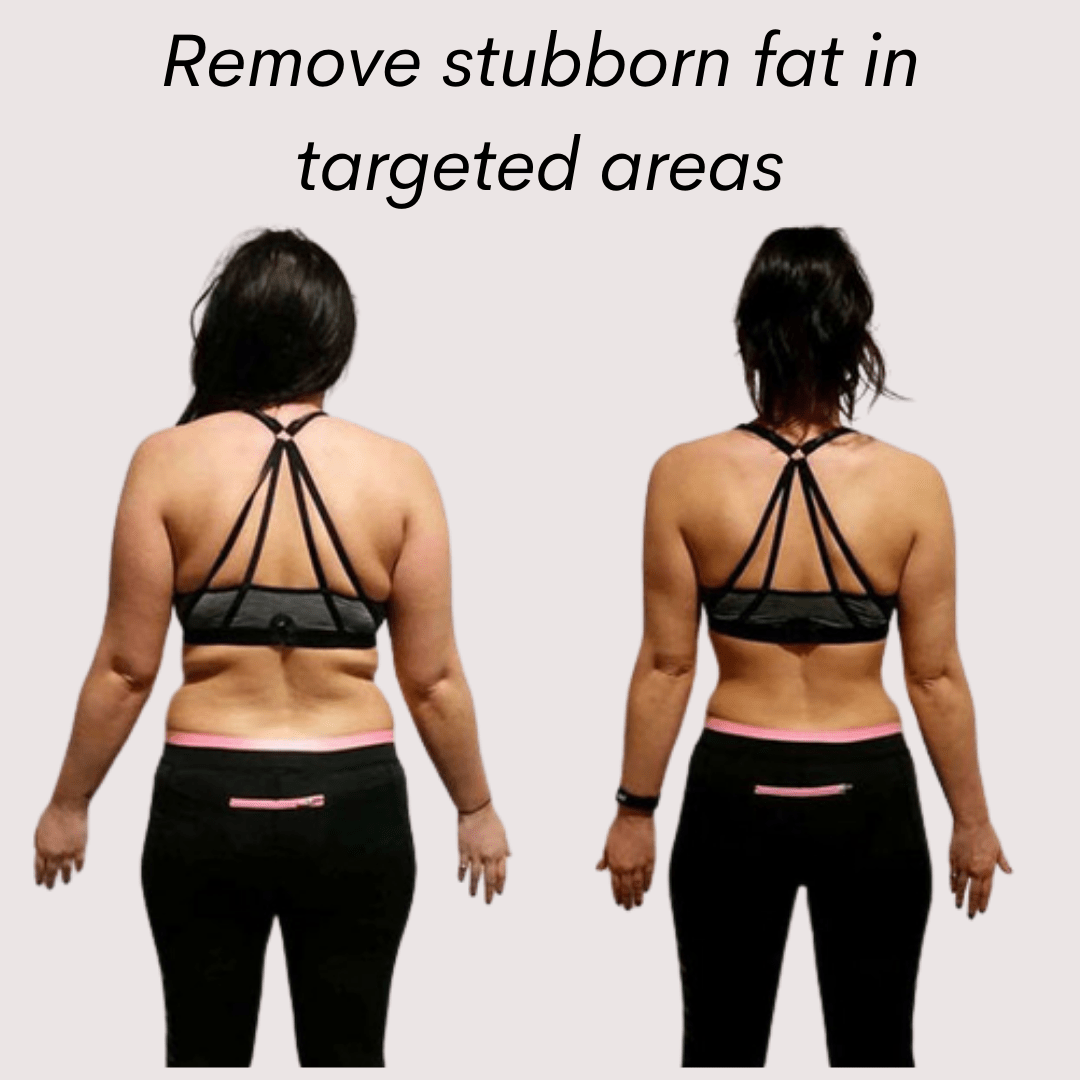 30k Cavitation Machine S-Shape with Lipo Laser - Foreverfly