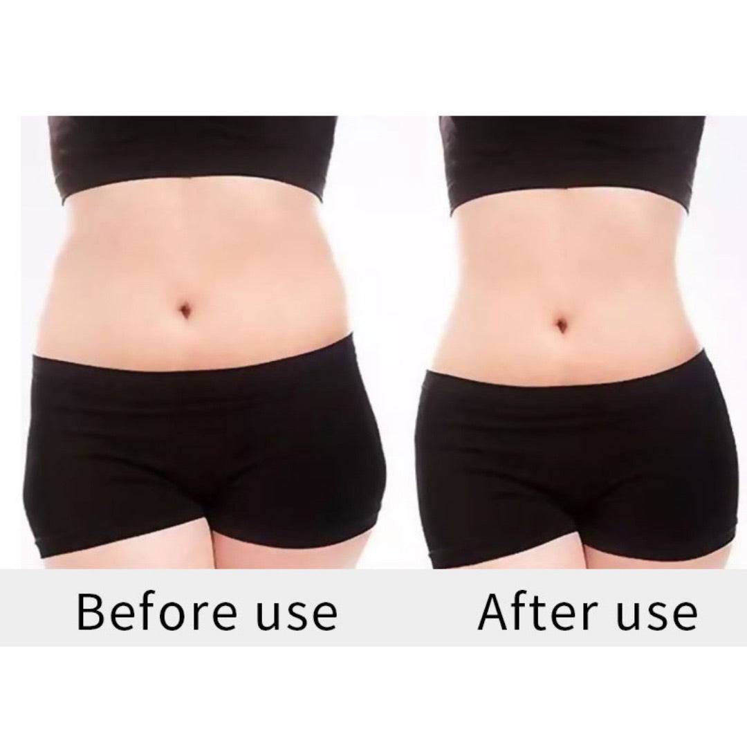 40k Cavitation RF Body Slimming Machine - Foreverfly
