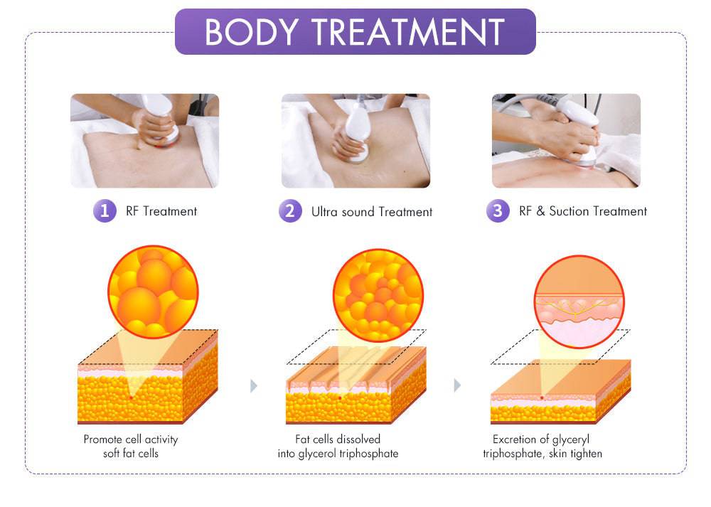 30K Cavitation S-Shape Mini - Foreverfly