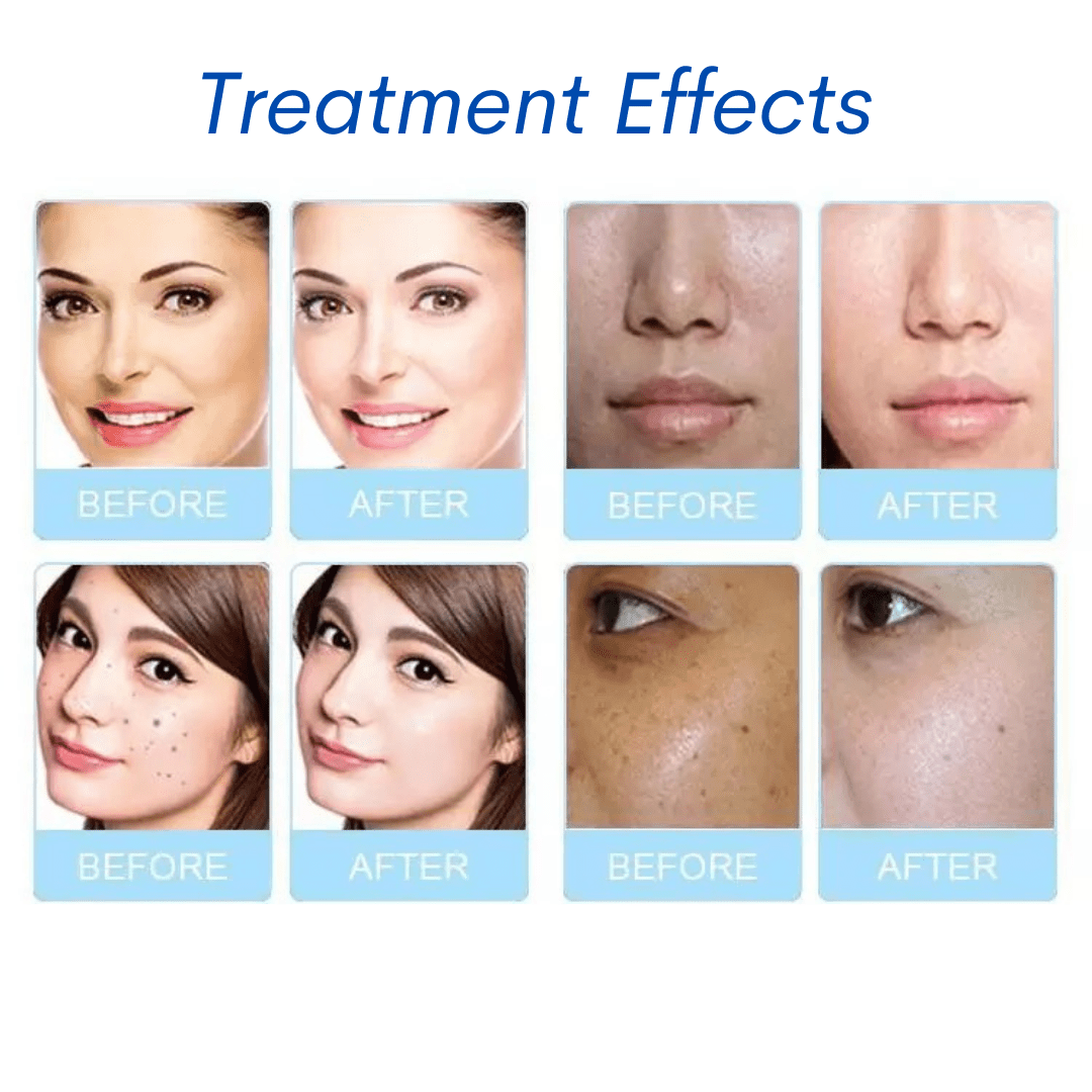 Concentrated Hydrafacial Solution 3pcs Set - Foreverfly