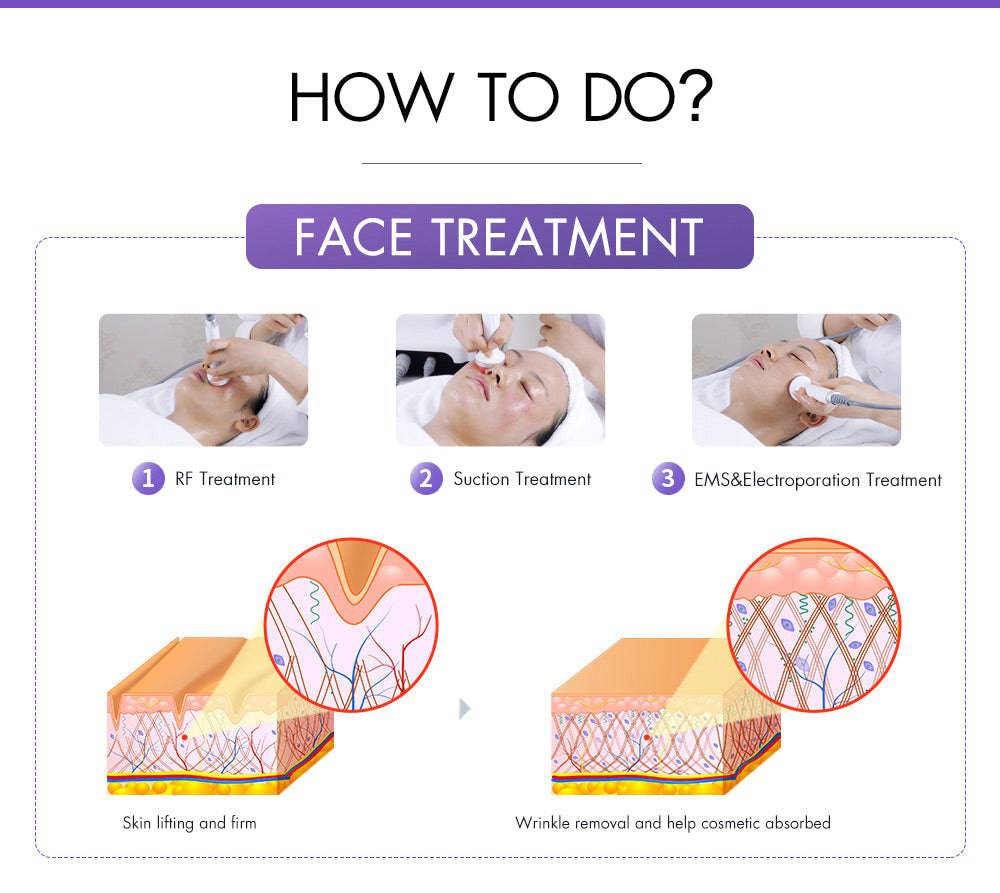 30K Cavitation S-Shape Mini - Foreverfly