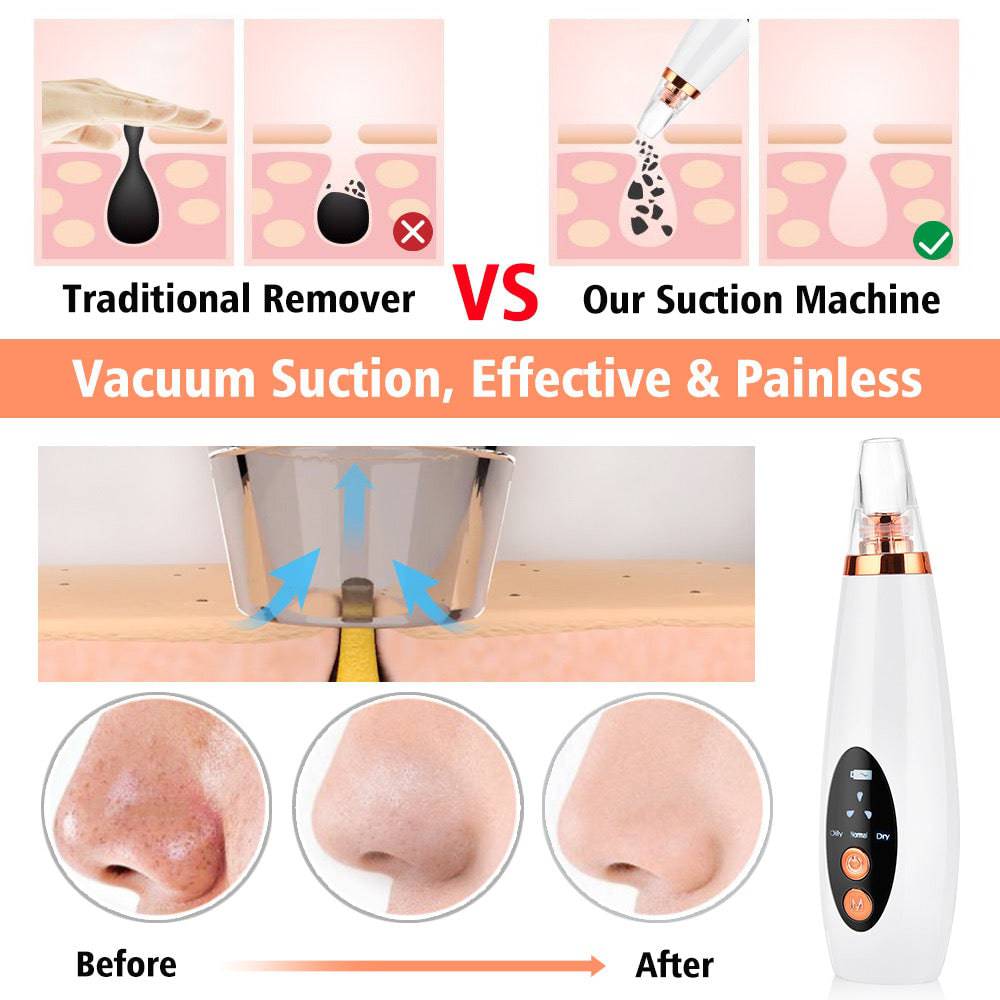 Electric Blackhead Remover Pore Cleaner - Foreverfly