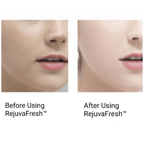 Ultrasonic Exfoliating Wand - Foreverfly