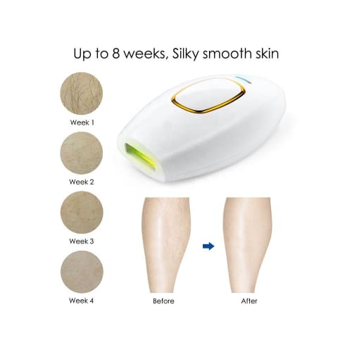 Foreverfly™ IPL Hair Removal - Foreverfly