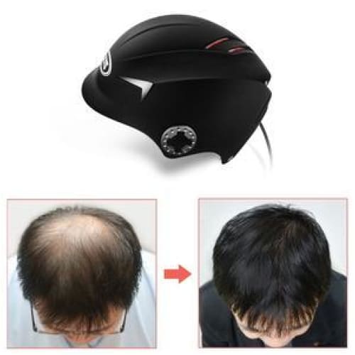 Hair Growth Laser Hat - Foreverfly