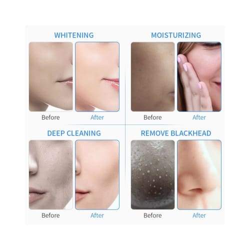 6 in 1 Portable Hydro Dermabrasion Machine Beauty Therapy - beauty tools - Best at home skin tightening devices 2020 - UK - Custom
