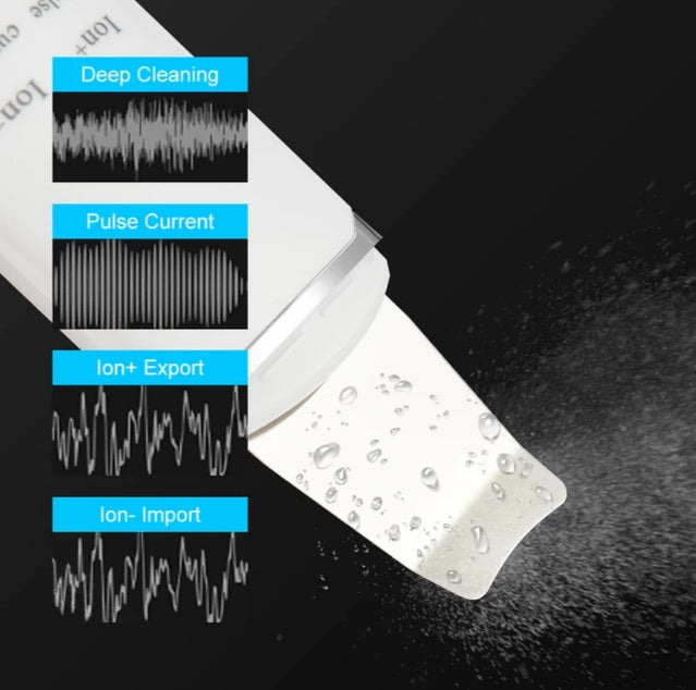 Ultrasonic Ion Skin Scrubber - Foreverfly 