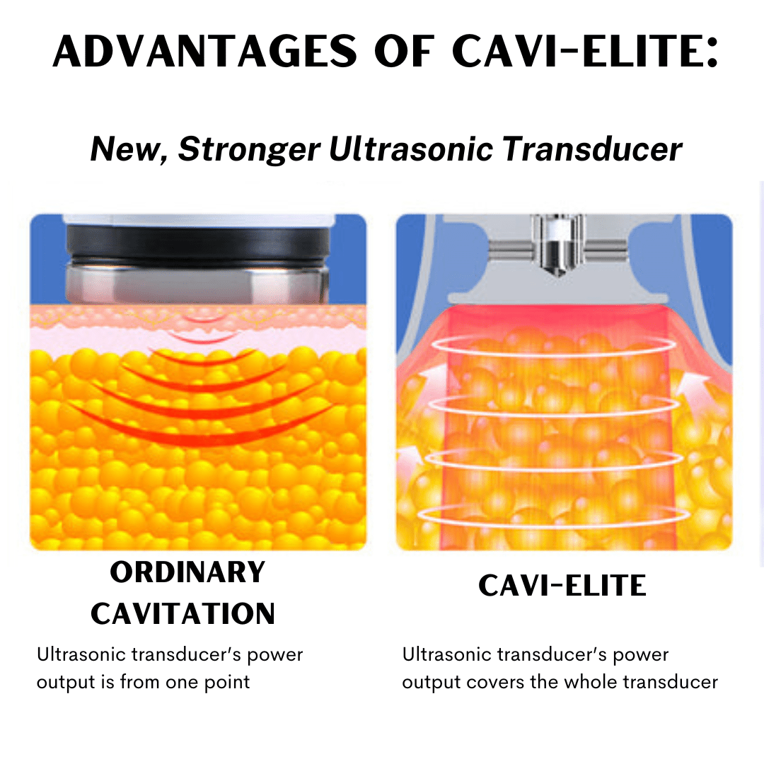 30K Cavitation Machine Cavi-Elite - Foreverfly 