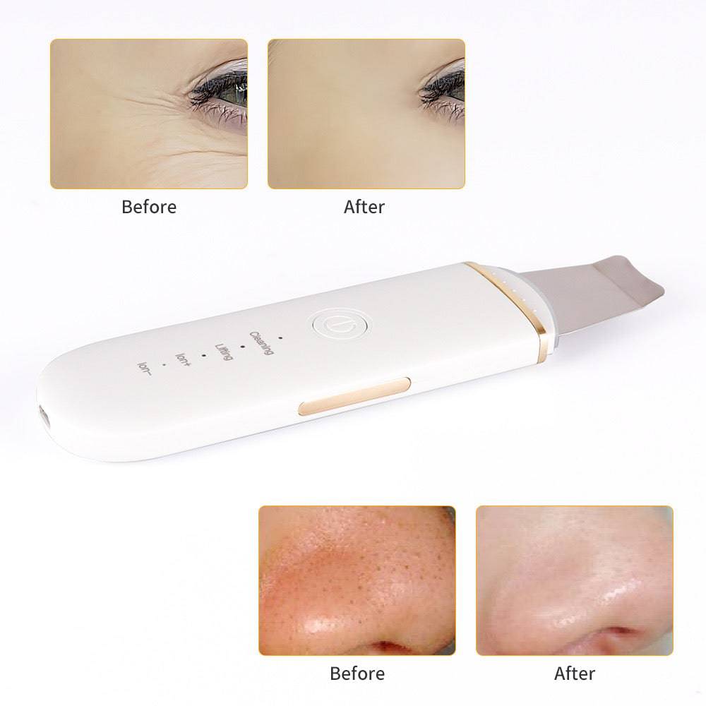 Ultrasonic Ion Skin Scrubber - Foreverfly 