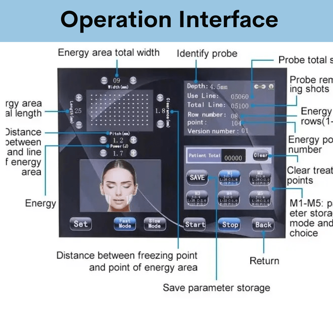 4D Face Lifting HIFU Machine - Foreverfly 