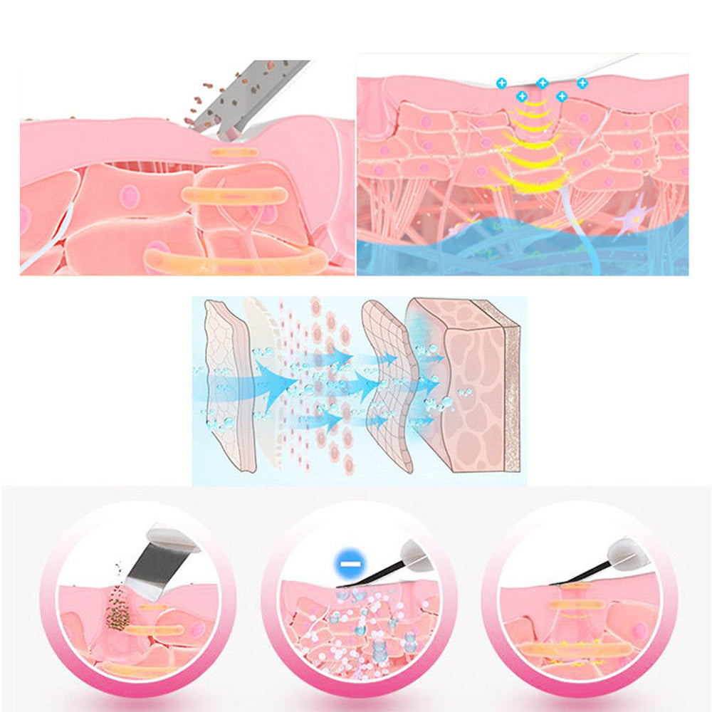 Ultrasonic Ion Skin Scrubber - Foreverfly 