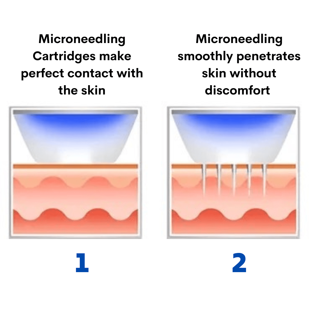 Beauty Disruptor Microneedling Machine 3 in 1 - Foreverfly 