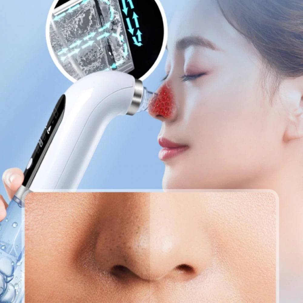 Super Micro Bubble Blackhead Remover - Foreverfly 